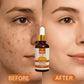 Relax Vitamin C Brightening Serum – 30ml